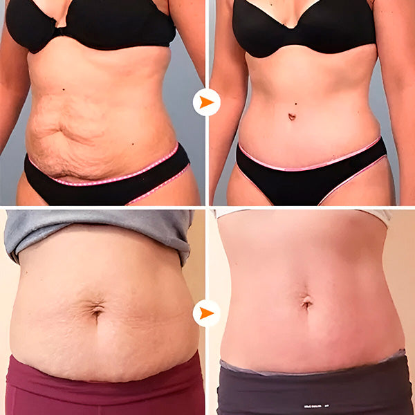 Anticeliulitinis muilas