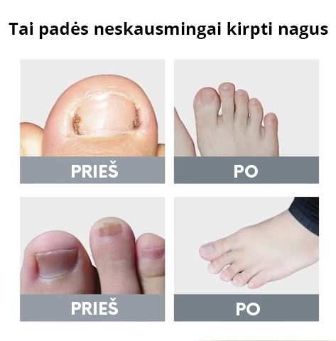 NailPro™ medicininės nagų žirklės