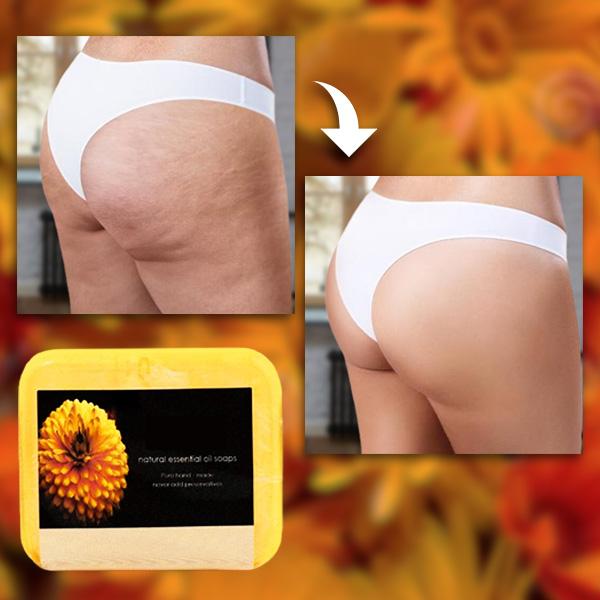 Anticeliulitinis muilas